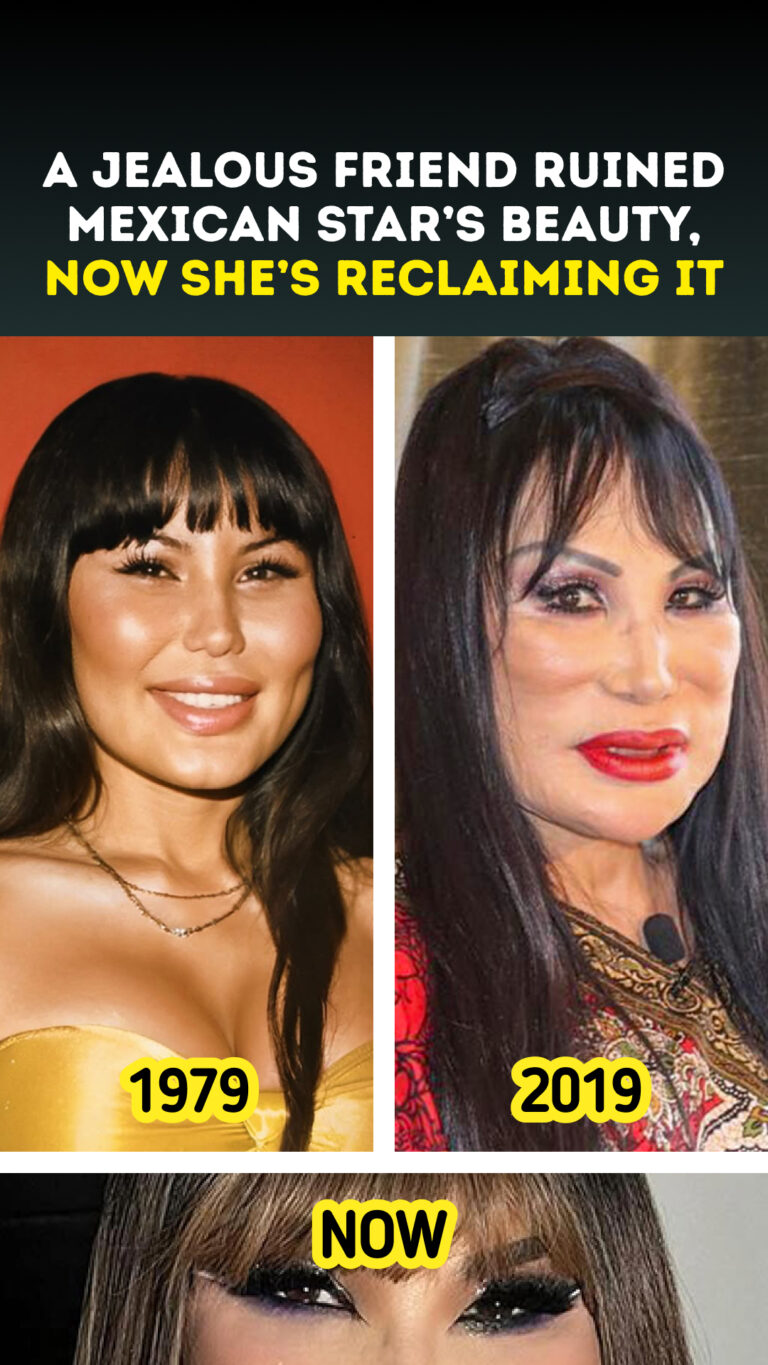 A Jealous Friend Ruined Mexican Star’s Beauty, Now She’s Reclaiming It