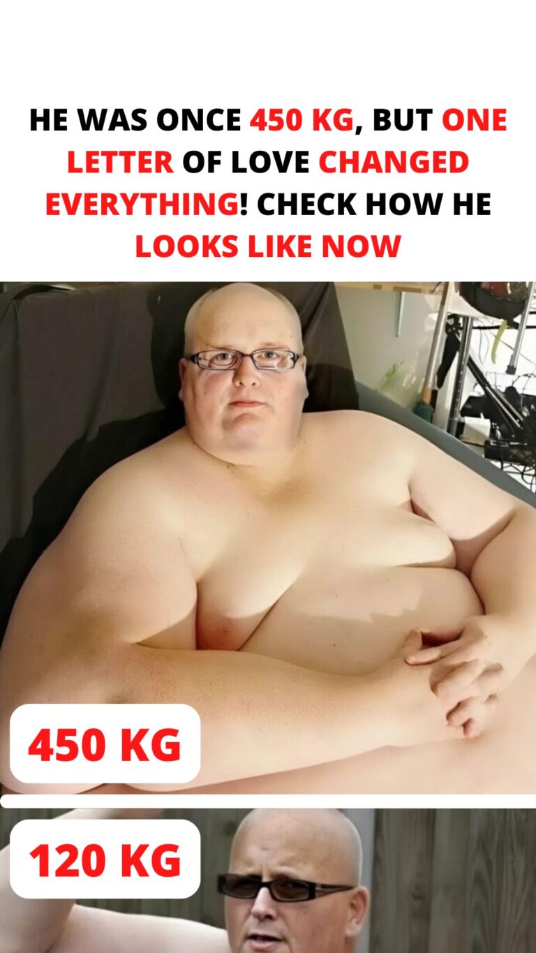 From 450 kg to a New Life — All Thanks to Love