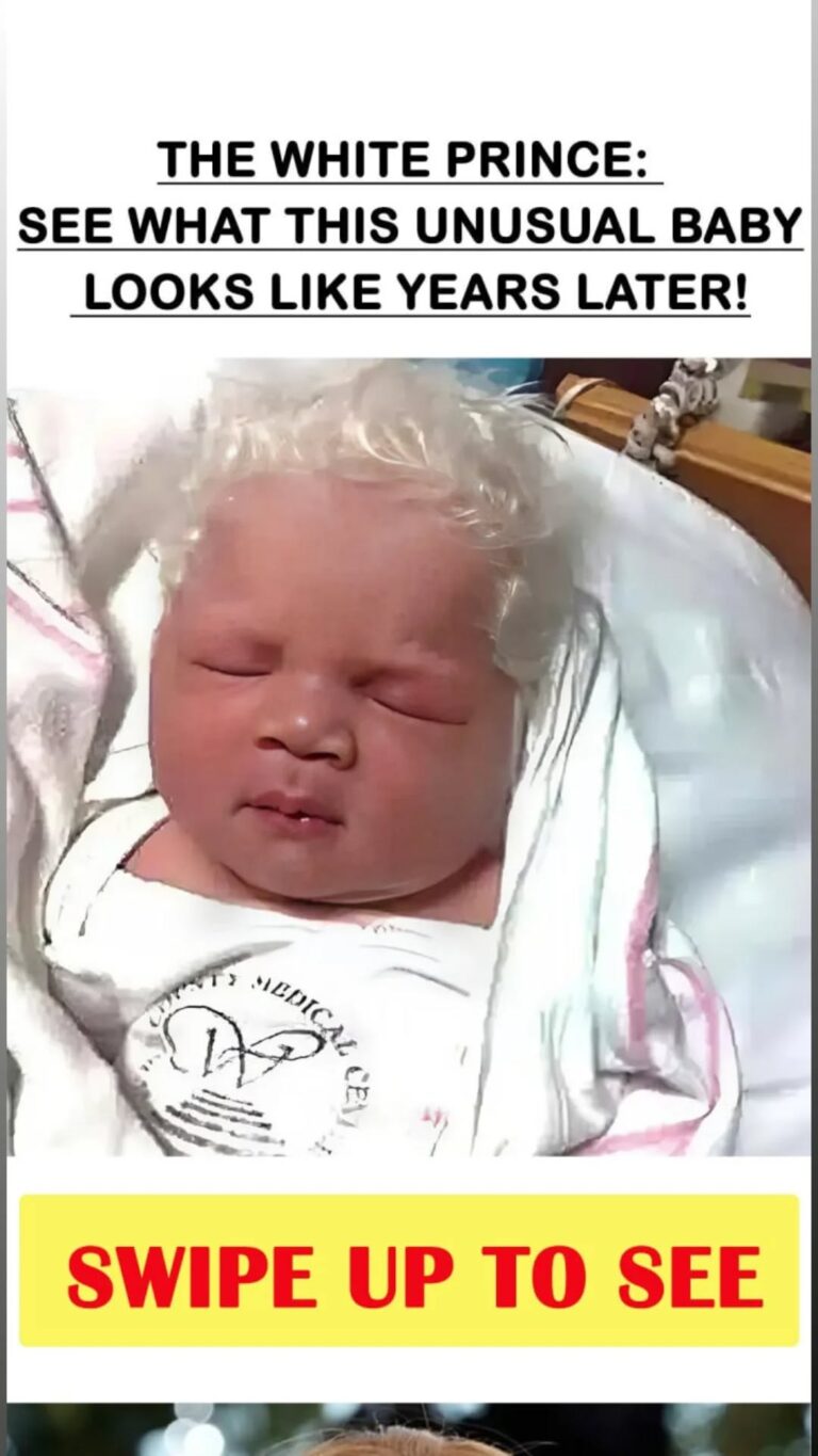 A Remarkable Mystery: Meet the Unique Baby Born With White Hair