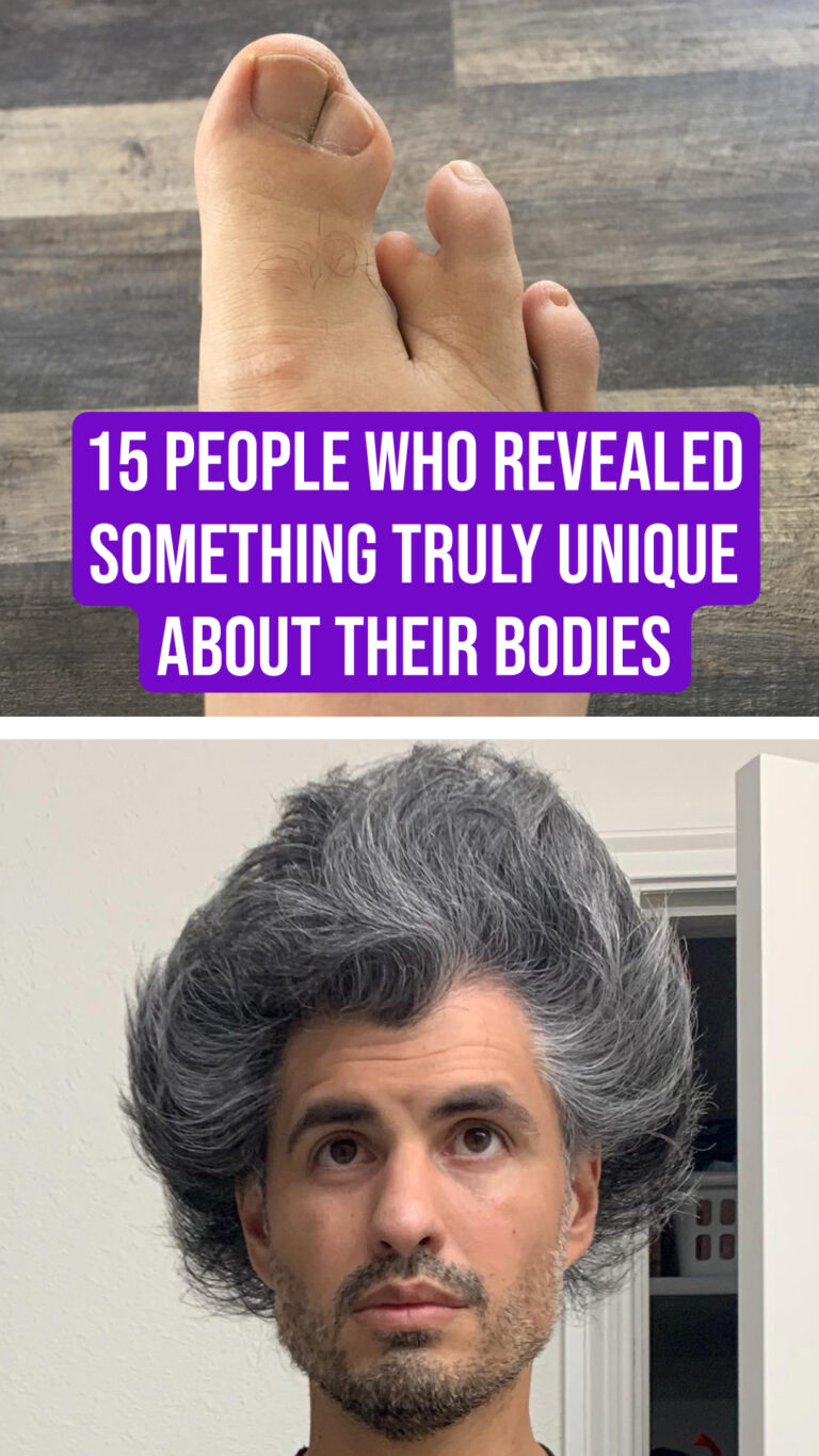 15 People Who Revealed Something Truly Unique About Their Bodies