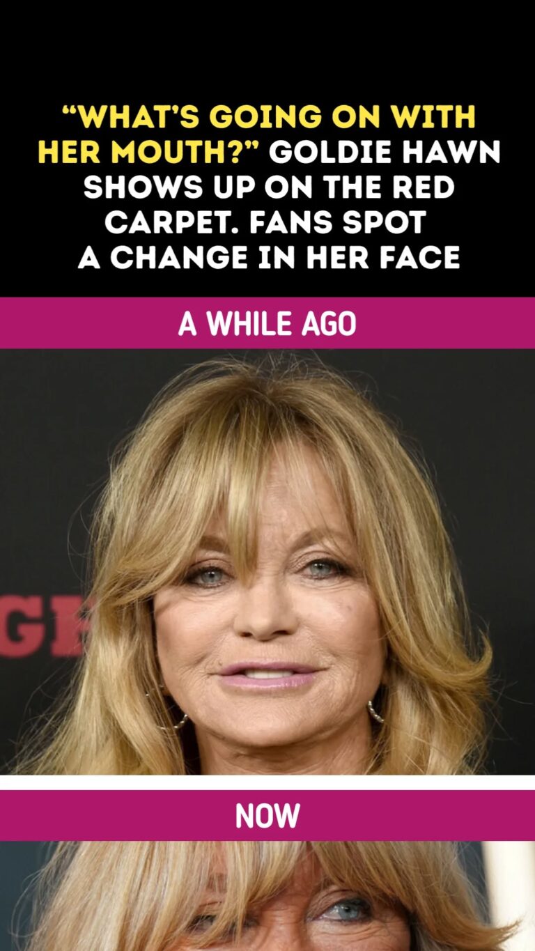 “What’s Going On With Her Mouth?” Goldie Hawn Shows Up on the Red Carpet, and Some Fans Spot a Change in Her Face