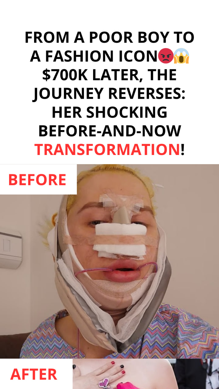 Following $700,000 Worth of Procedures, This Individual Begins De-Transitioning Once More (before/After Photos)