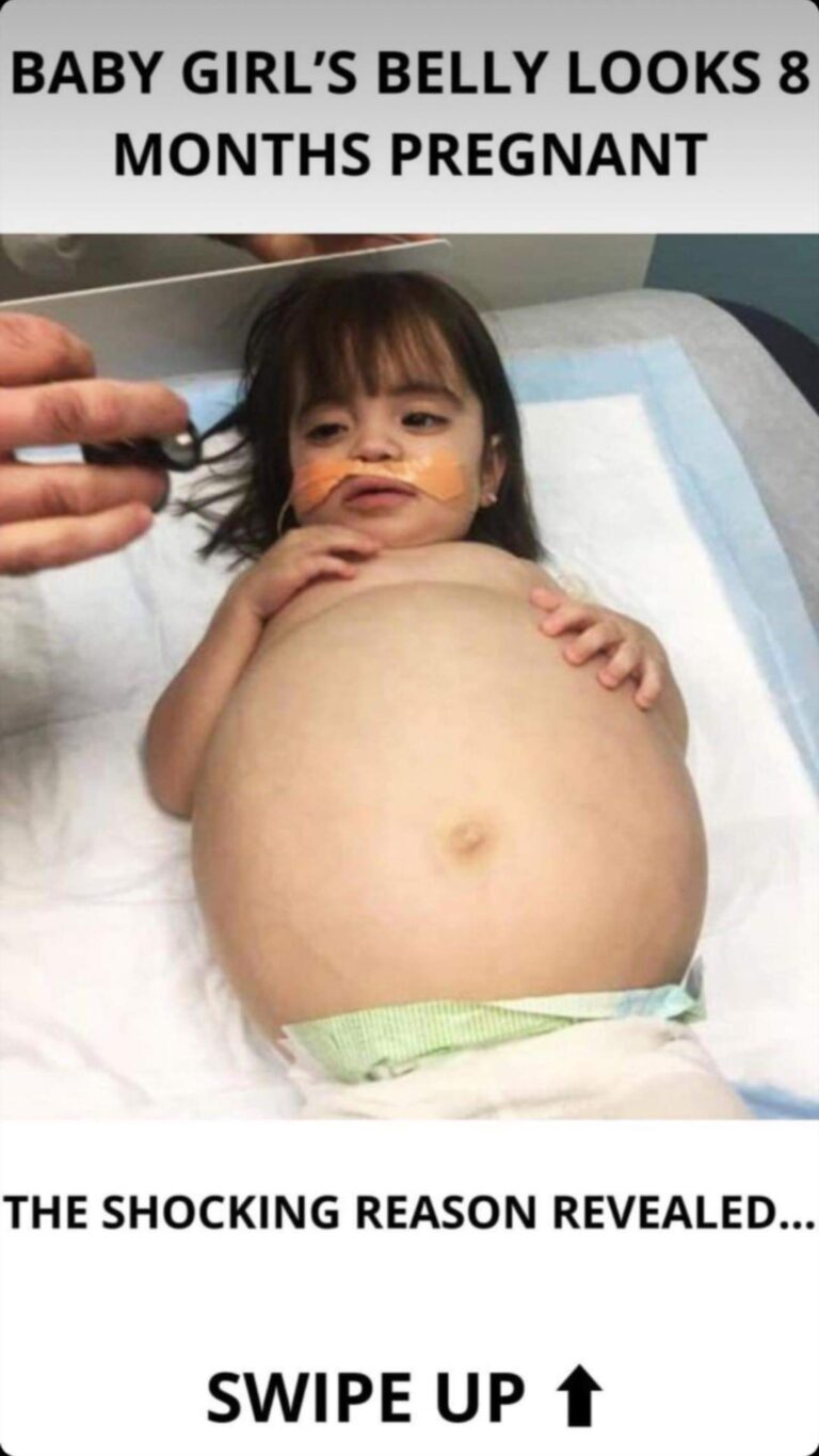 Little girl who looked 8 months’ pregnant because of deadly disease is saved thanks to dad’s kidney donation