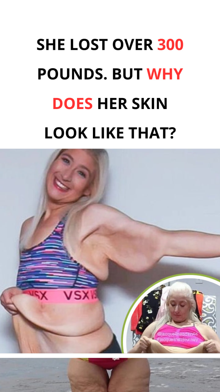 Woman with saggy skin criticized online. She didn’t lose her cool and gave a caustic response to the haters!