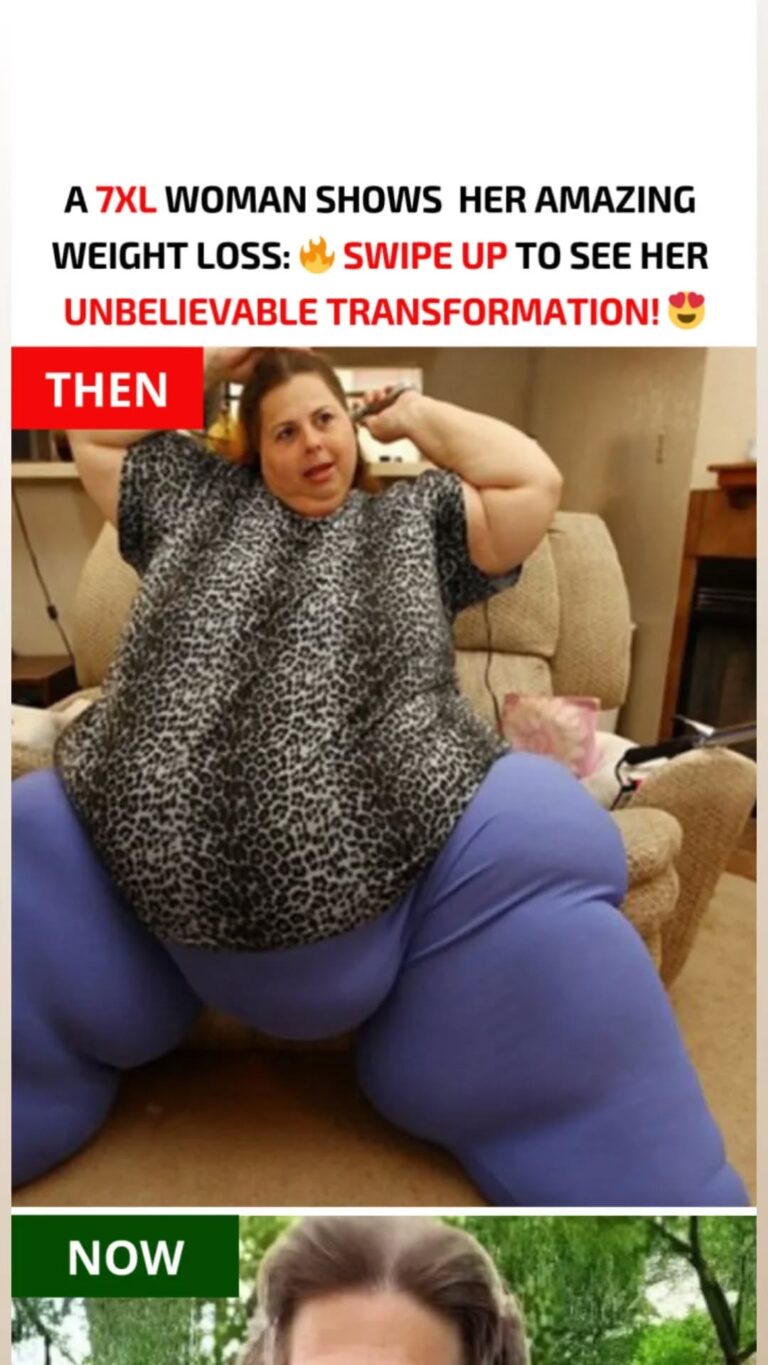 What determination! What does the woman who, at the age of 57, successfully lost 518 pounds look like now?