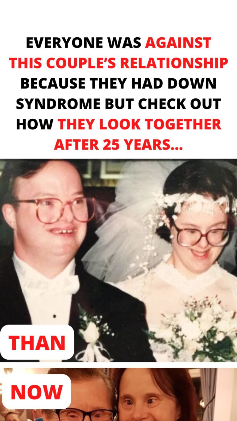 Everyone was against this couple’s relationship because they had Down Syndrome but check out how they look together after 25 years…