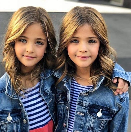 13 Years Ago They Were Called The Worlds Most Beautiful Twins, Now Look At Them