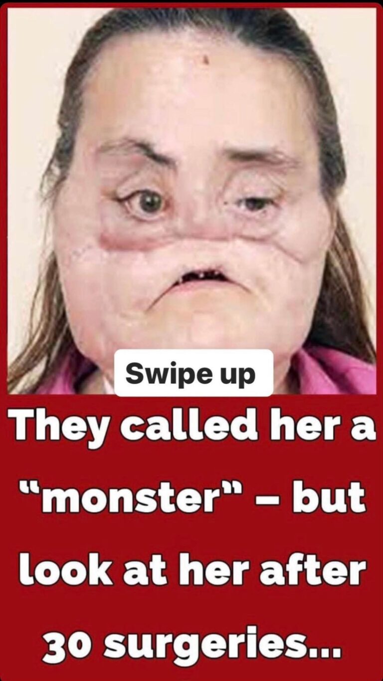 Connie Culp became the first-ever face transplant patient in the US: Inside her remarkable story