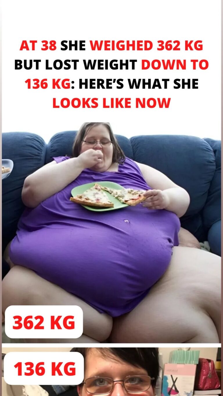 At 38 she weighed 362 kg but lost weight down to 136 kg: here’s what she looks like after all the changes