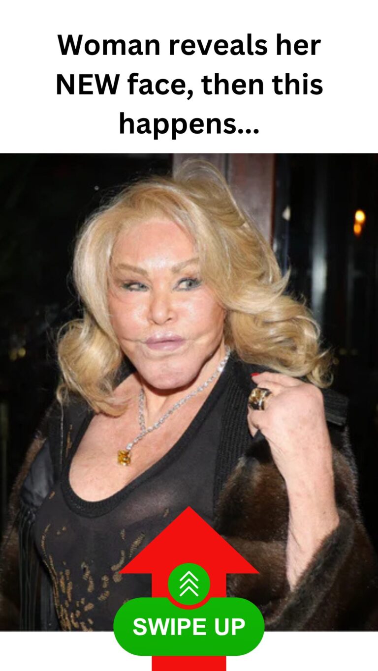When Celebrity Plastic Surgeries Go Wrong—See The Bizarre Transformations!