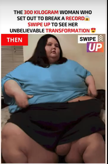 Sophie Laurent’s 238 Kg Transformation That Shocked Everyone
